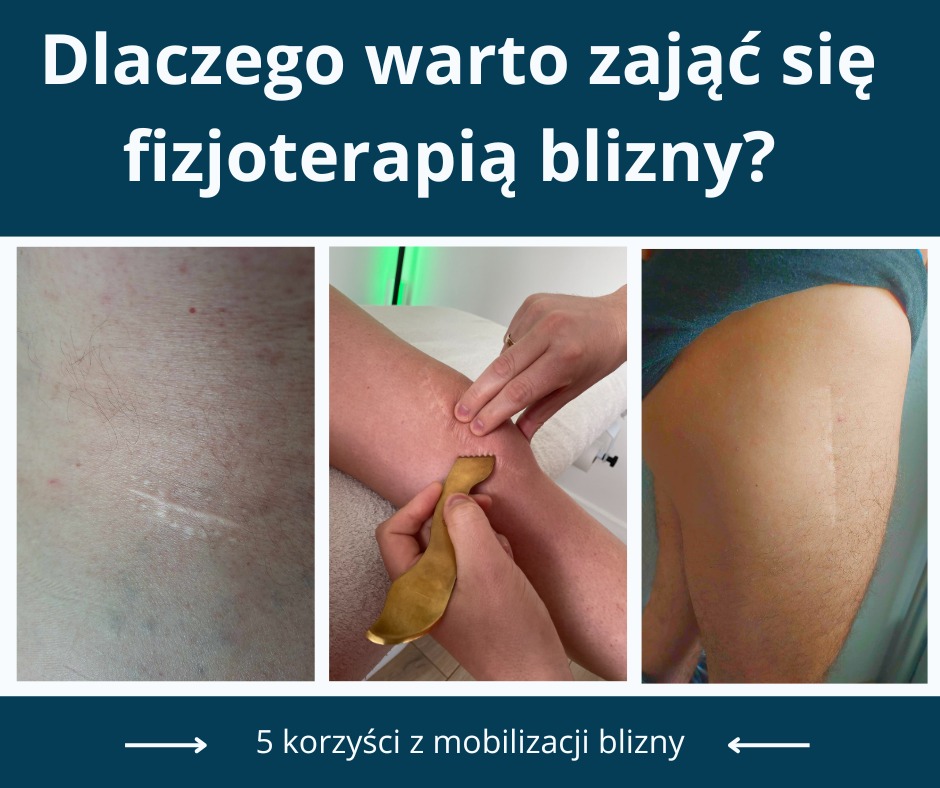 fizjoterapia Brzeszcze, rehabilitacja Brzeszcze, terapia wisceralna