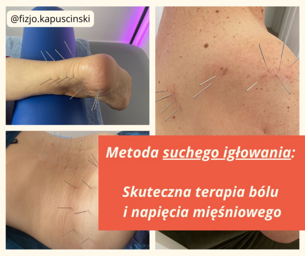 Fizjoterapia Brzeszcze, rehabilitacja Brzeszcze